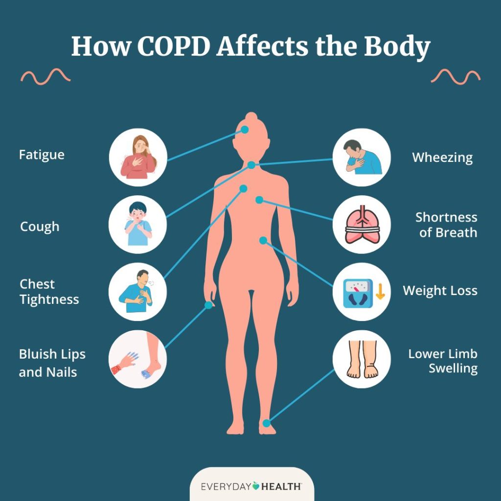 How to Prevent COPD: Simple Steps to Protect Your Lungs