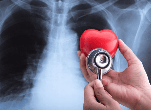 Pulmonary Fibrosis Oxygen Use